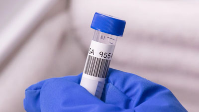 Een laborant houdt een testbuisje vast met een cryogeen polyesterlabel van Brady erop aangebracht. Op het label is zowel tekst als een barcode geprint.